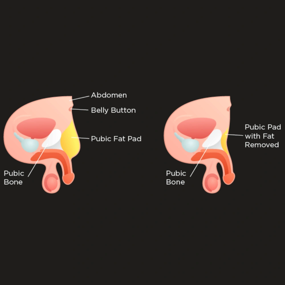 Reproductive Cosmetology Consultation Mangalore