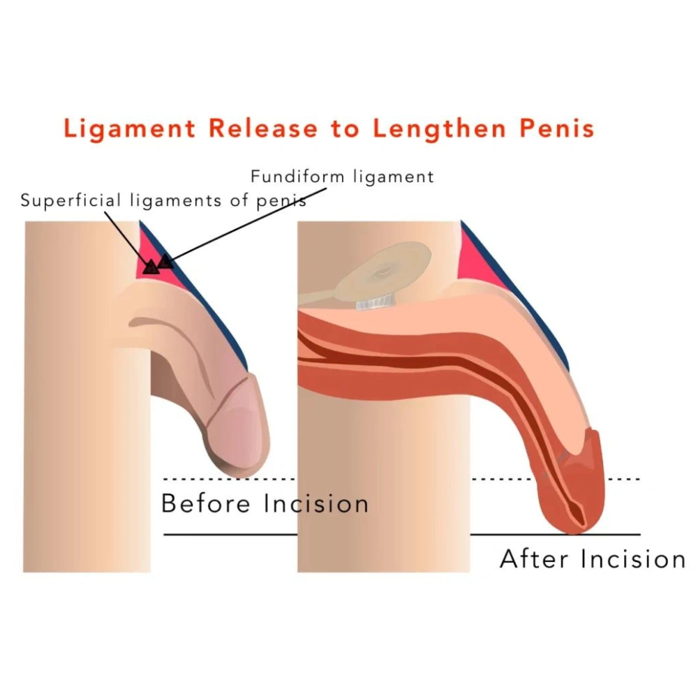 Male Cosmetic Surgery Clinic Mangalore