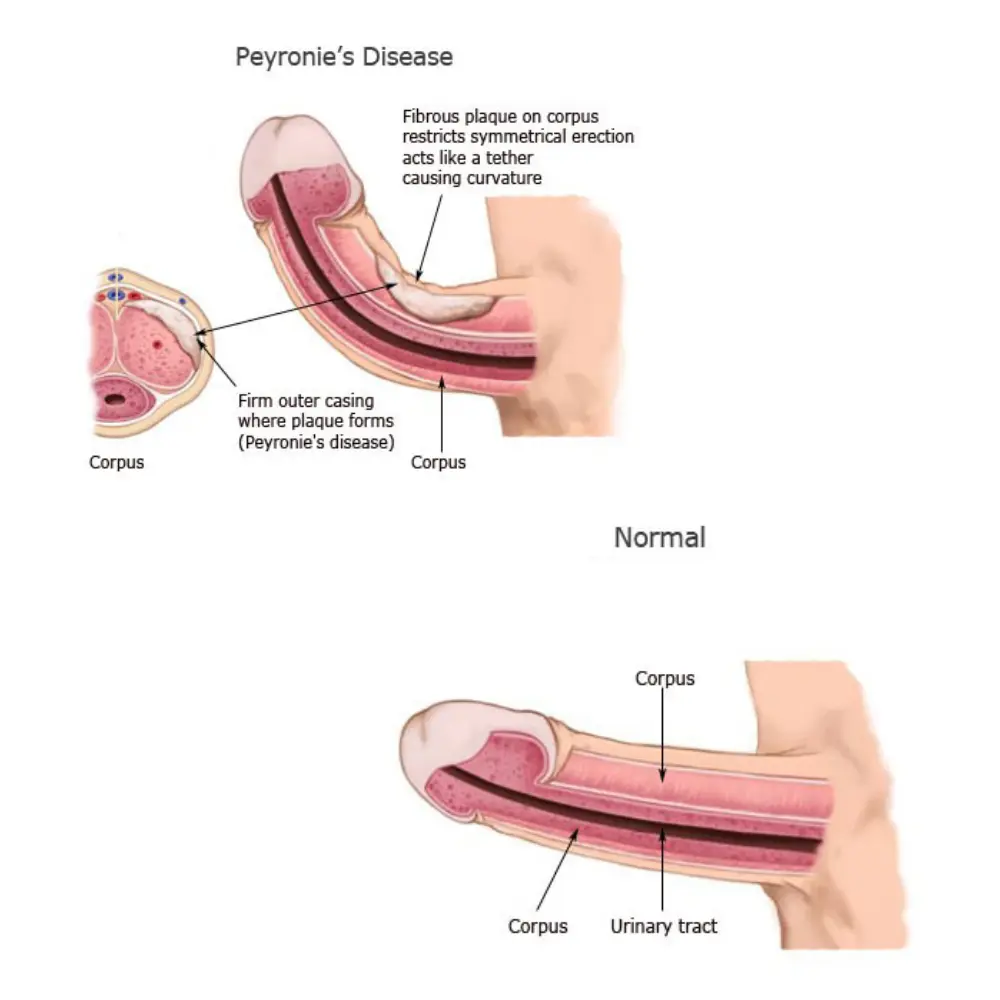 Mens Sexual Health Clinic Mangalore
